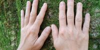 Hände am Baum Hände berühren fühlend einen Baum